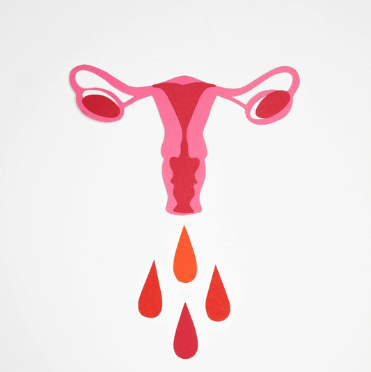 Endometriose: Wenn die Periode zur Qual wird